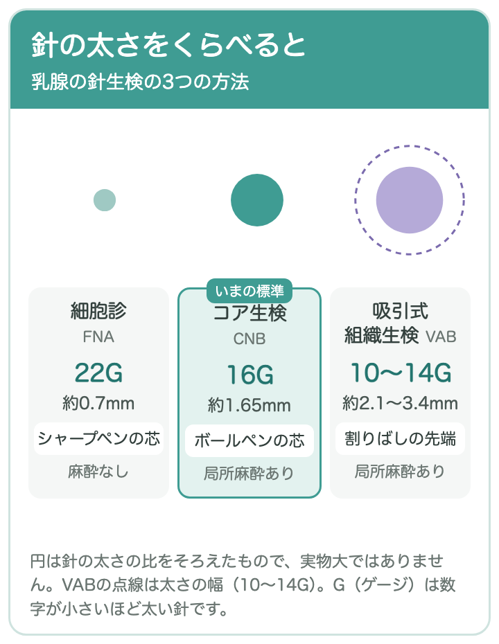 針の太さの比較：細胞診（22G・約0.7mm・シャープペンの芯・麻酔なし）、コア生検（16G・約1.65mm・ボールペンの芯・局所麻酔あり・いまの標準）、吸引式組織生検（10〜14G・約2.1〜3.4mm・割りばしの先端・局所麻酔あり）